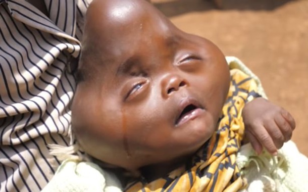 Ребенок в Руанде